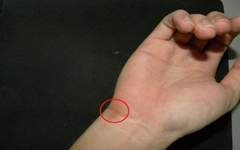 每天玩电脑3小时，90%的人都得了这个病！